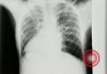 Standbild weltweit erste motion picture X-Ray Italien, 1953, aus Sekunde 32 historischem Filmmaterial Videoclip 65675069098