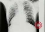 Standbild weltweit erste motion picture X-Ray Italien, 1953, aus Sekunde 33 historischem Filmmaterial Videoclip 65675069098