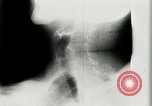 Standbild weltweit erste motion picture X-Ray Italien, 1953, aus Sekunde 43 historischem Filmmaterial Videoclip 65675069098