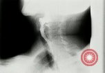 Standbild weltweit erste motion picture X-Ray Italien, 1953, aus Sekunde 44 historischem Filmmaterial Videoclip 65675069098