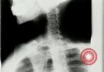 Standbild weltweit erste motion picture X-Ray Italien, 1953, aus Sekunde 45 historischem Filmmaterial Videoclip 65675069098