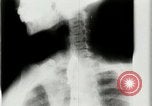 Standbild weltweit erste motion picture X-Ray Italien, 1953, aus Sekunde 46 historischem Filmmaterial Videoclip 65675069098