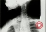 Standbild weltweit erste motion picture X-Ray Italien, 1953, aus Sekunde 47 historischem Filmmaterial Videoclip 65675069098