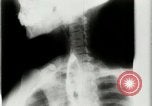 Standbild weltweit erste motion picture X-Ray Italien, 1953, aus Sekunde 48 historischem Filmmaterial Videoclip 65675069098