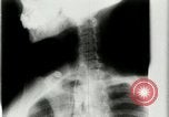 Standbild weltweit erste motion picture X-Ray Italien, 1953, aus Sekunde 49 historischem Filmmaterial Videoclip 65675069098