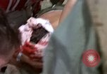 Standbild Evakuierung von Verletzten Vietnam, 1965, aus Sekunde 17 historischem Filmmaterial Videoclip 65675070291