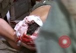 Standbild Evakuierung von Verletzten Vietnam, 1965, aus Sekunde 18 historischem Filmmaterial Videoclip 65675070291