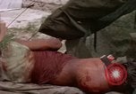 Image d'évacuation des blessés Vietnam, 1965, de la seconde 32 séquences d'archives historiques vidéo 65675070292
