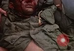 Standbild Evakuierung von Verletzten über Huey Hubschrauber Vietnam, 1965, aus Sekunde 15 historischem Filmmaterial Videoclip 65675070295