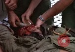 Standbild Evakuierung von Verletzten über Huey Hubschrauber Vietnam, 1965, aus Sekunde 17 historischem Filmmaterial Videoclip 65675070295