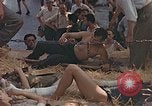 Image of wounded soldiers France, 1945, second 34 stock footage video 65675070337