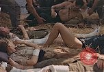 Image of wounded soldiers France, 1945, second 35 stock footage video 65675070337