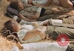 Image of wounded soldiers France, 1945, second 37 stock footage video 65675070337
