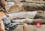 Image of wounded soldiers France, 1945, second 39 stock footage video 65675070337
