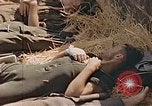 Image of wounded soldiers France, 1945, second 41 stock footage video 65675070337