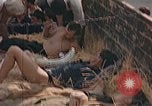 Image of wounded soldiers France, 1945, second 43 stock footage video 65675070337