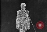 Image of human glands United States USA, 1922, second 31 stock footage video 65675070865