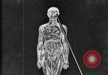 Image of human glands United States USA, 1922, second 41 stock footage video 65675070865