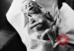 Image of 1920s reproductive health education United States USA, 1922, second 19 stock footage video 65675070867