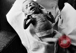 Image of 1920s reproductive health education United States USA, 1922, second 22 stock footage video 65675070867