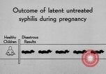 Standbild Syphilis United States USA, 1935, aus Sekunde 47 historischem Filmmaterial Videoclip 65675070869