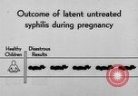 Standbild Syphilis United States USA, 1935, aus Sekunde 48 historischem Filmmaterial Videoclip 65675070869