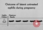 Standbild Syphilis United States USA, 1935, aus Sekunde 49 historischem Filmmaterial Videoclip 65675070869