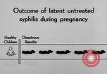 Standbild Syphilis United States USA, 1935, aus Sekunde 50 historischem Filmmaterial Videoclip 65675070869