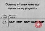Standbild Syphilis United States USA, 1935, aus Sekunde 51 historischem Filmmaterial Videoclip 65675070869