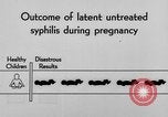 Standbild Syphilis United States USA, 1935, aus Sekunde 53 historischem Filmmaterial Videoclip 65675070869