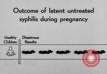 Standbild Syphilis United States USA, 1935, aus Sekunde 54 historischem Filmmaterial Videoclip 65675070869