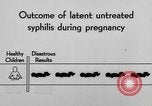 Standbild Syphilis United States USA, 1935, aus Sekunde 57 historischem Filmmaterial Videoclip 65675070869