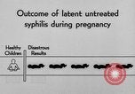 Standbild Syphilis United States USA, 1935, aus Sekunde 59 historischem Filmmaterial Videoclip 65675070869