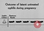 Standbild Syphilis United States USA, 1935, aus Sekunde 60 historischem Filmmaterial Videoclip 65675070869