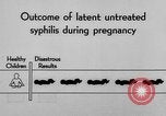 Standbild Syphilis United States USA, 1935, aus Sekunde 62 historischem Filmmaterial Videoclip 65675070869