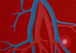 Image of benefits of aerobic exercise United States USA, 1970, second 50 stock footage video 65675071868