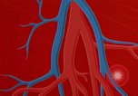 Image of benefits of aerobic exercise United States USA, 1970, second 51 stock footage video 65675071868
