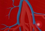 Image of benefits of aerobic exercise United States USA, 1970, second 52 stock footage video 65675071868