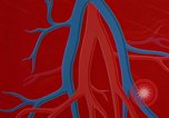 Image of benefits of aerobic exercise United States USA, 1970, second 55 stock footage video 65675071868