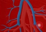Image of benefits of aerobic exercise United States USA, 1970, second 61 stock footage video 65675071868