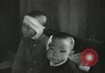 Image of Japanese patients Nagasaki Japan, 1945, second 52 stock footage video 65675074793