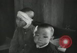 Image of Japanese patients Nagasaki Japan, 1945, second 53 stock footage video 65675074793