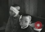 Image of Japanese patients Nagasaki Japan, 1945, second 55 stock footage video 65675074793