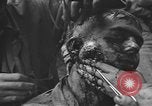 Image of American medics Normandy France, 1944, second 40 stock footage video 65675076254