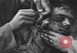 Image of American medics Normandy France, 1944, second 55 stock footage video 65675076254