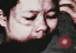 Image of wounded children airlifted via helicopter Vietnam, 1966, second 15 stock footage video 65675077439