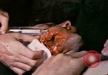 Image of wounded Marine Iwo Jima, 1945, second 3 stock footage video 65675077473
