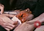 Image of wounded Marine Iwo Jima, 1945, second 4 stock footage video 65675077473