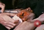 Image of wounded Marine Iwo Jima, 1945, second 6 stock footage video 65675077473
