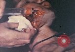 Image of wounded Marine Iwo Jima, 1945, second 8 stock footage video 65675077473